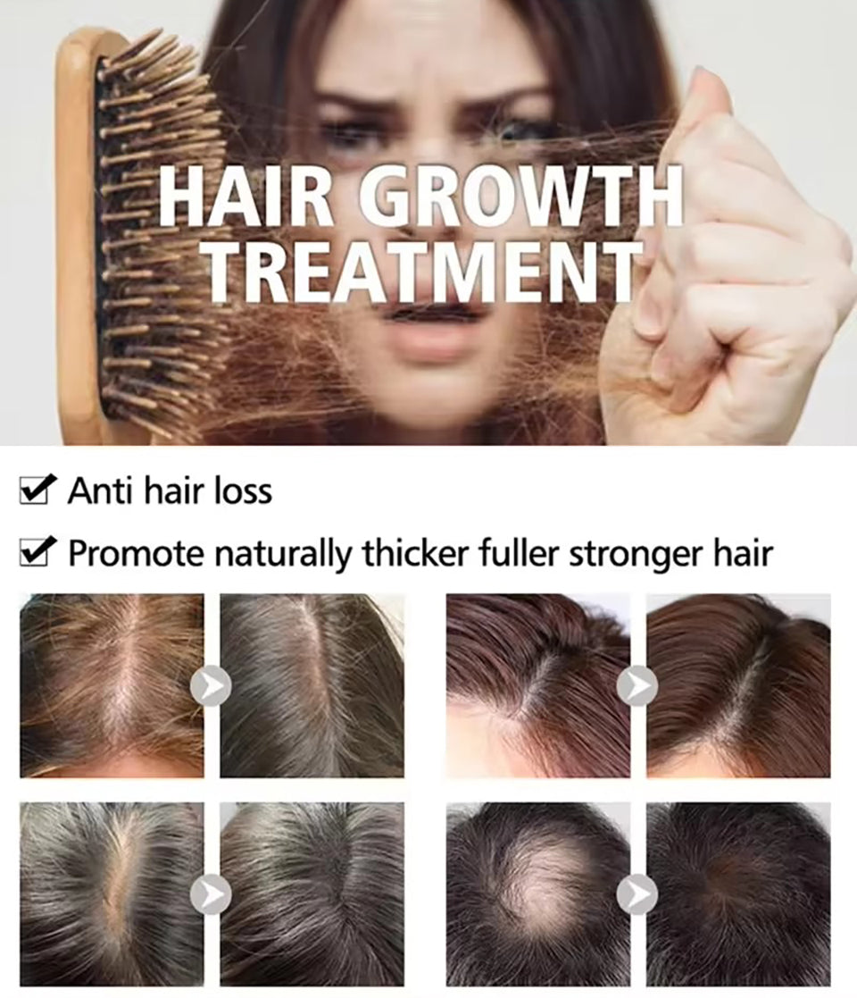 Kaqier Rosemary Hair Care Set